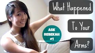 Ask Rebekah #1: What Happened To Your Arms?