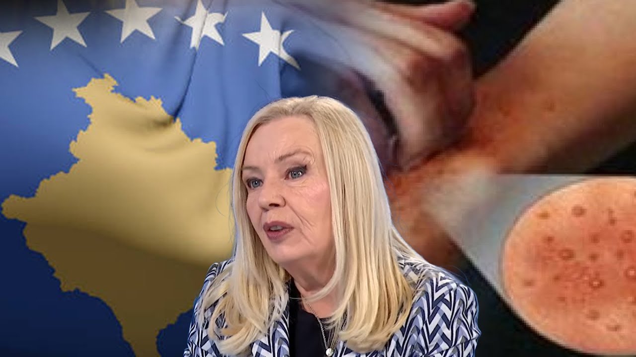 Zgjeba apo “zhuga”, po përhapet në vendin tonë si…/ Duhet rreth 30 ditë që…