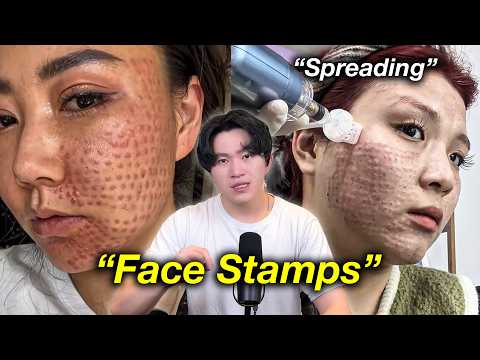 China's Disturbing “Face Dots” Disaster