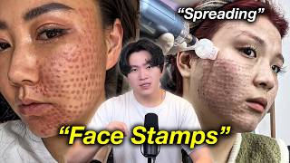 China's Disturbing “Face Dots” Disaster