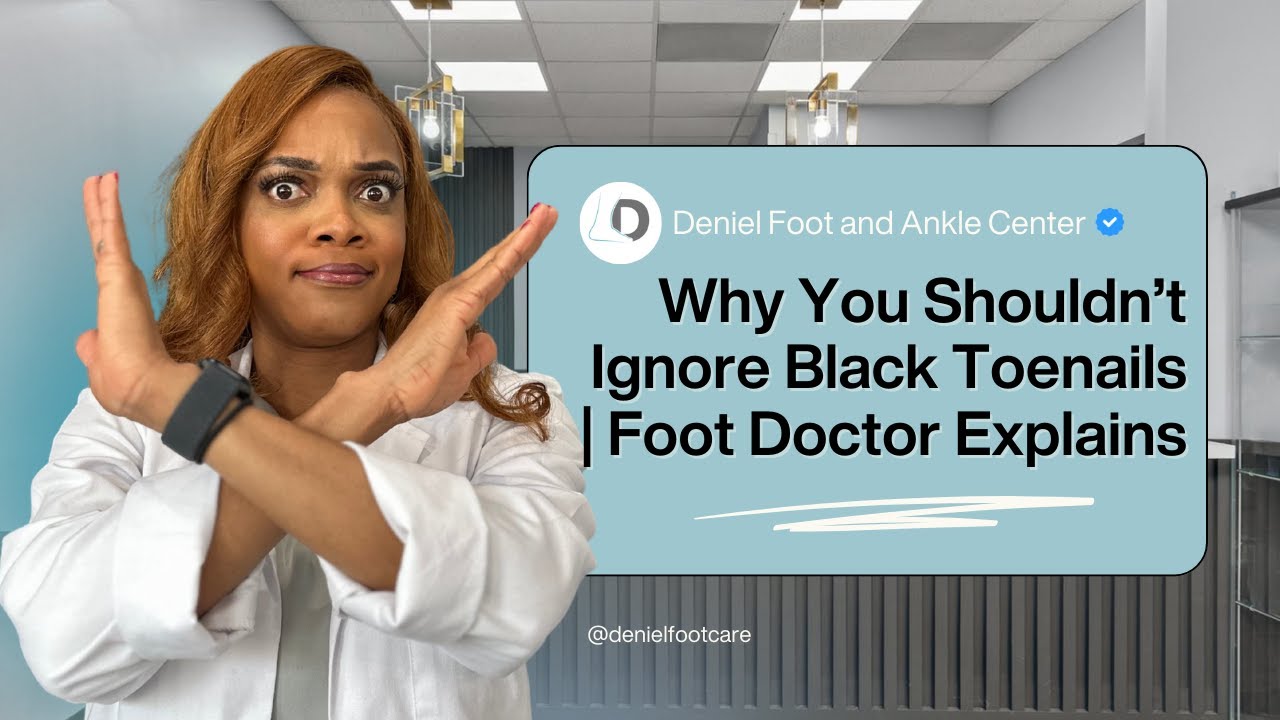 Black Toenails Are NOT Normal – What It Really Means!