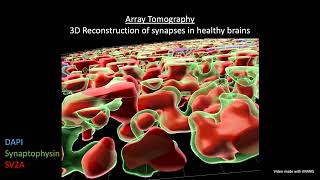 Array Tomography: Visualise human brain synapses in 3D!
