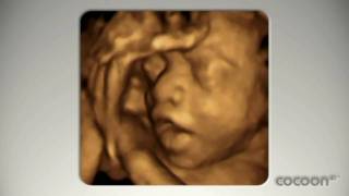 Cocoon4D versus other baby scans