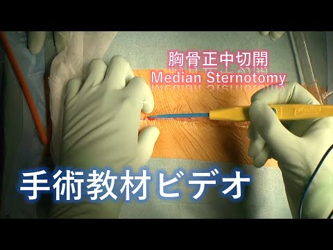 手術教材ビデオ（手術手技）】: Video Altas for surgical technique