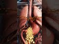 What Happens Inside Your Body After Drinking Alcohol? | 3D Medical Animation. #alcohol