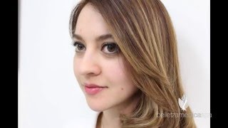 Lip Filler in Belletza Medica Spa - Sergio Verduzco MD