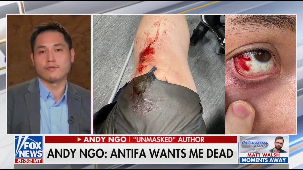 Andy Ngo responds to May 2021 Antifa assault