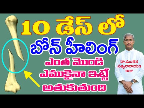 ఎముకల విషయంలో ఇది పక్కా తెలుసుకోవాలి| How to Heal Bone Fracture | Dr Manthena Satyanarayana Raju