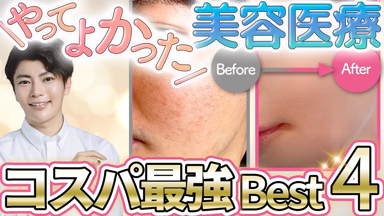 【肌管理Best4】やってよかった！美肌になれるエイジング美容医療・施術を紹介【シミ・シワ・ニキビ跡・たるみ】