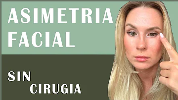 ¿Cómo corregir asimetria facial natural?