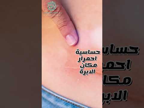 ابر المونجارو الآثار الجانبية الشائعة