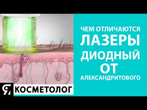 Чем отличаются лазеры – диодный от александритового? Лазерная эпиляция