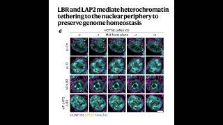 Download Lagu 978-LBR & LAP2: for Peripheral Heterochromatin Anchoring Download Lagu 978-LBR & LAP2: for Peripheral Heterochromatin Anchoring