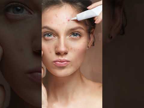 Мучает изжога? /  Признаки проблем с ЖКТ! #shorts