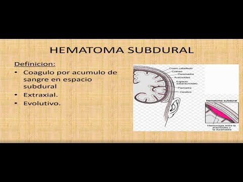 Vídeo: ¿Qué Es El Hematoma Subdural Crónico?