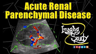 Acute Renal Parenchymal Disease || Ultrasound || Case 181