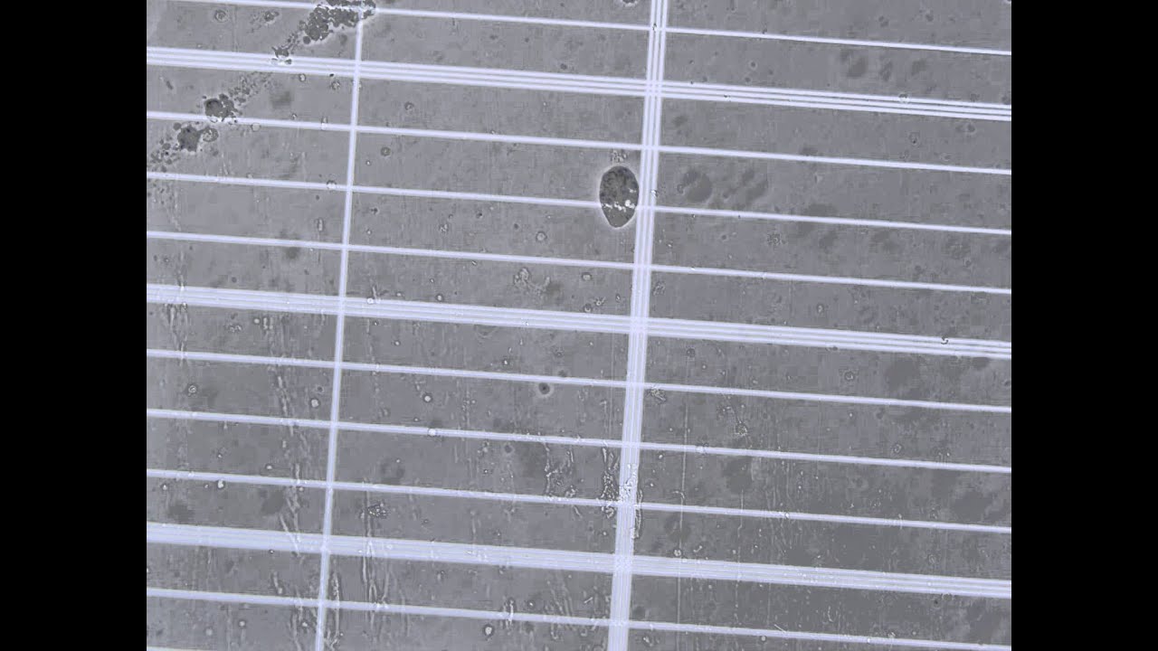 Hemocytes Attacking a Ciliate