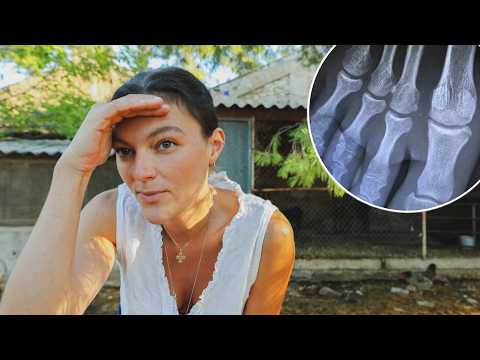 I broke my foot... let me tell you the story