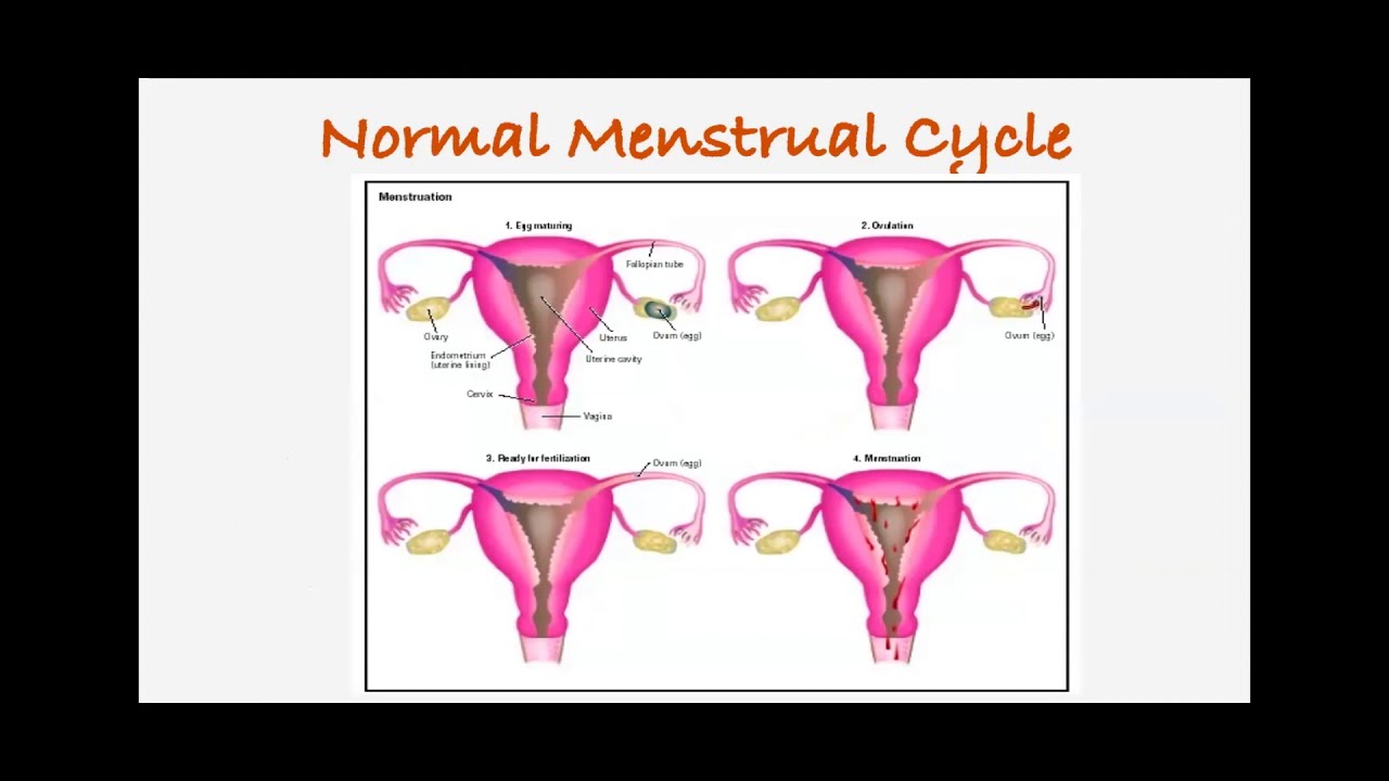 "Live Life Fibroid Free" Health Talk [Webinar]