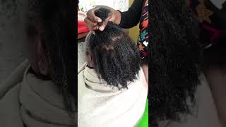 Struggling with alopecia? Eunik's treatment works wonders💚Watch the results speak for themselves