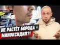 Почему не растет борода? Как на самом деле работает МИНОКСИДИЛ?