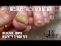 Pedicure Tutorial: Stop Hiding Your Nails Optical Illusion for Thick Toenails