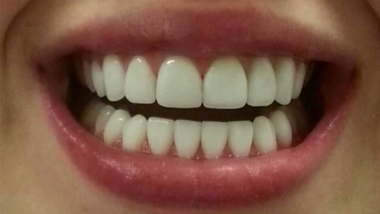 Perfect Teeth & Flawless Smile Subliminal ✨ Instantly Straighter, Whiter & Beautiful Teeth
