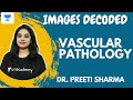 IMAGES DECODED | EPS 5 | VASCULAR PATHOLOGY | MUST KNOW IMAGES IN PATHOLOGY | DR. PREETI SHARMA