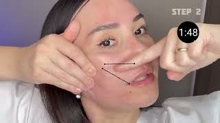 What Type of Nasolabial Folds Do You Have? Find Out and Get Rid of Them