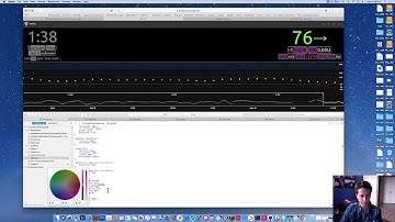 GitHub and nightscout