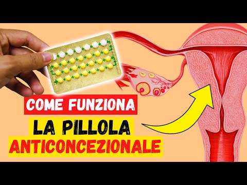 Come funziona la pillola anticoncezionale? Cos&rsquo;è e a cosa serve?  - Tecniche di contraccezione