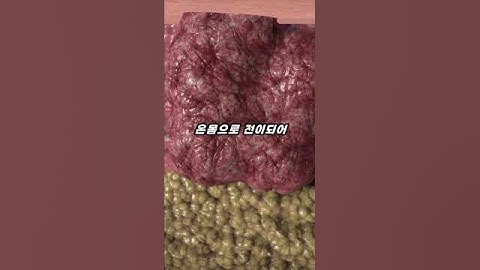 불법 의료행위로 발견된 70년 동안 분열을 멈추지 않는 불멸의 세포 🦠 #shorts
