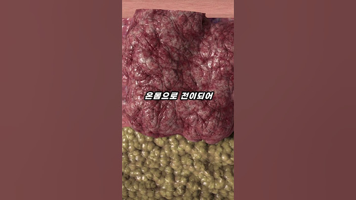 불법 의료행위로 발견된 70년 동안 분열을 멈추지 않는 불멸의 세포 🦠 #shorts