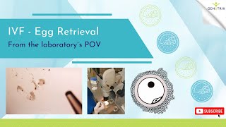 IVF Egg Retrieval - from the embryologist´s POV, IVF Prague