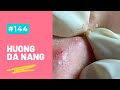 #144 | Huong Da Nang - Dung Part 2