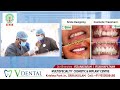 Best dental hospital in srikakulam  expert dental care at v dental care  v dental hospital