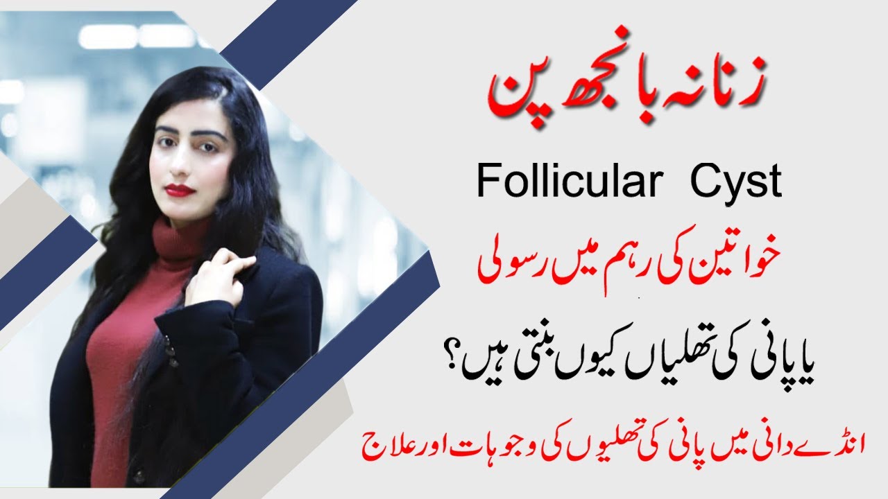 Reham May Pani Ki Theli Ka Ilaj Treatment Of Ovarian Cyst Follicular Cyst Kaya Hay YouTube
