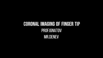 Coronal Image of Finger Tip Prof Ignatov.Mr. Denev Color Coronal Image