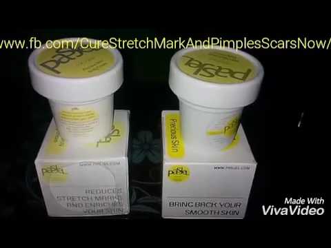 pasjel stretch mark removal