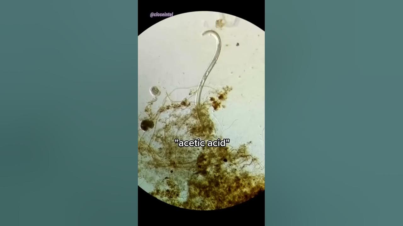 Vinegar vs germs under microscope white vinegar youtube