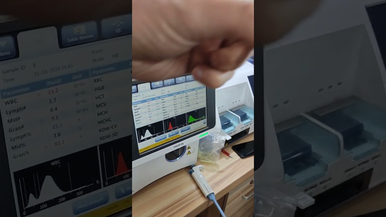 #كيفية_اجراء_فحص#CBC#للأطفال