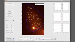 Famous FISH-QUANT: mature mRNA counting (Part 2) Wealth