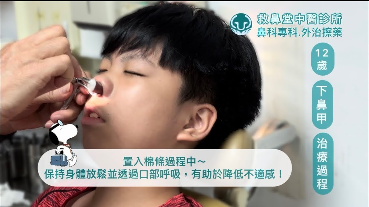 兒童鼻病|下鼻甲肥大治療|免開刀擦藥療法 - YouTube