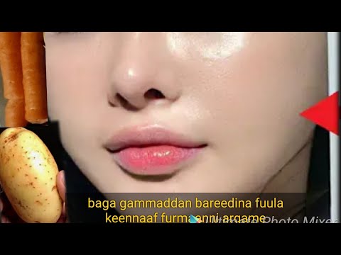 Dawaa Maadeetaafii Bareedina Fuula Keennaaf Bu Aa Qabeessa Ta Uuf Video Kana Daawwadhaa 100