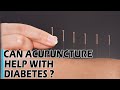 Can Acupuncture Help With Diabetes | Best Health Tips | DR C L Venkat Rao |  Health And Beauty