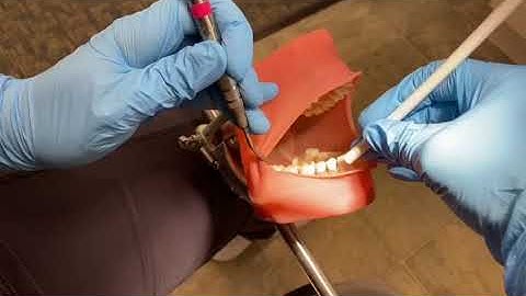 Lab #4 Mirror and Anterior Fulcrum