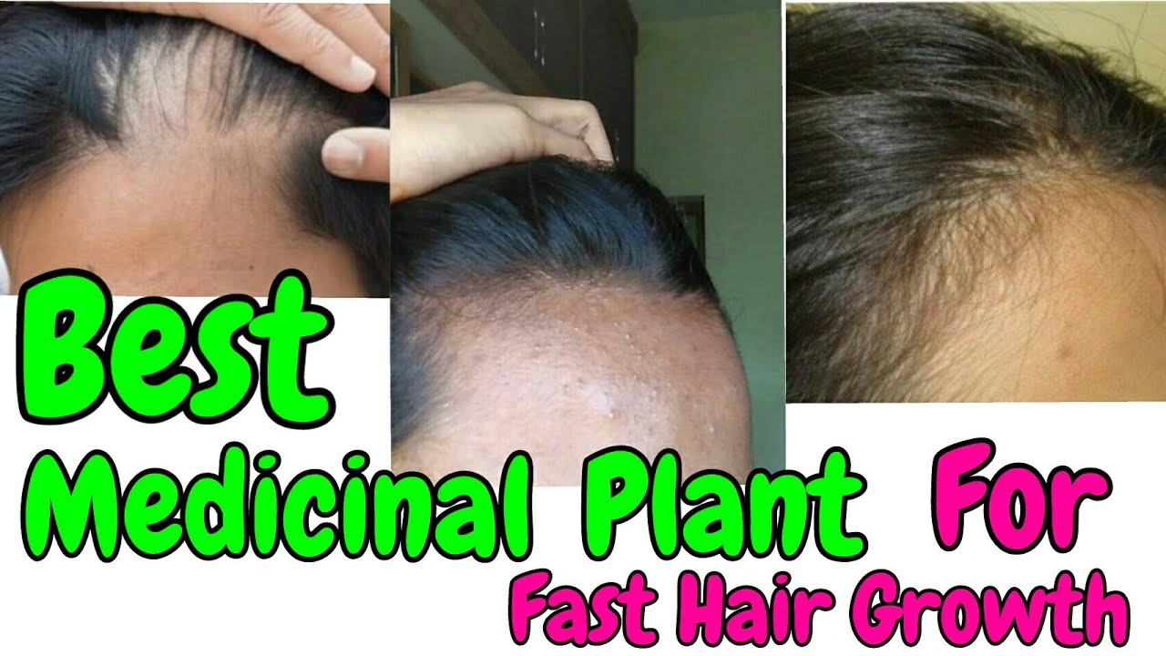 Hair Growth Medicinal Plants you Must Have | Best Medicinal Plants For Fast Hair  Growth|Shinny Roops - YouTube