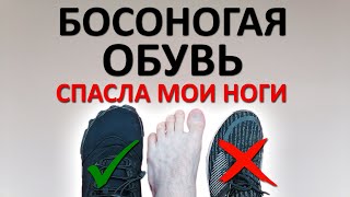 Босоногая обувь СПАСЛА мои НОГИ. Что такое BAREFOOT обувь? Где её искать?