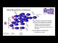 Traitement du myélome nouvellement diagnostiqué et du myélome récidivant   réfractaire