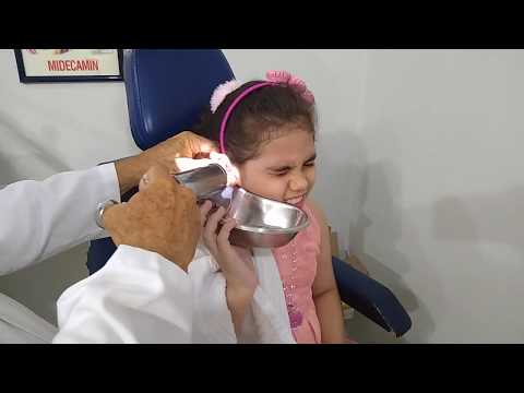 Vídeo: Como remover os tampões de cera de ouvido (com fotos)